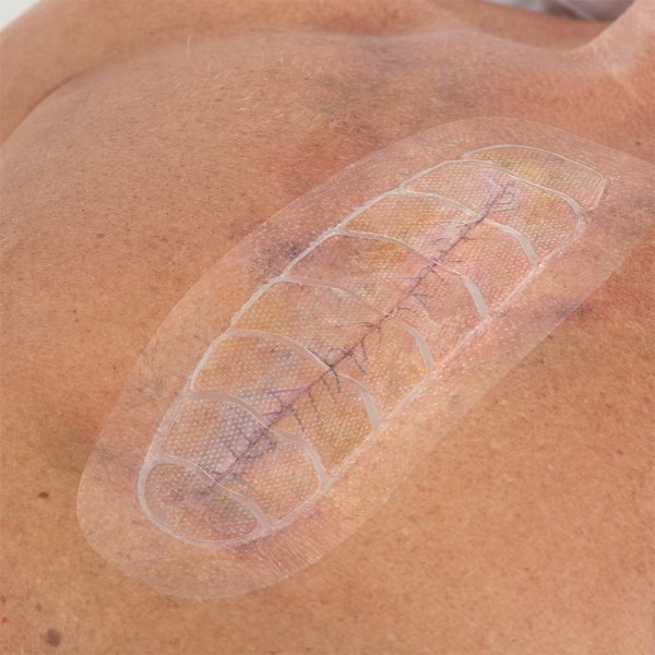 Pansement Leukomed Control